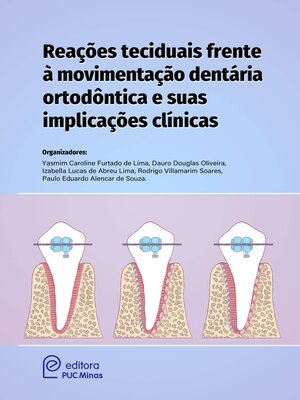 cover image of Reações teciduais frente à movimentação dentária ortodóntica e suas implicações clínicas